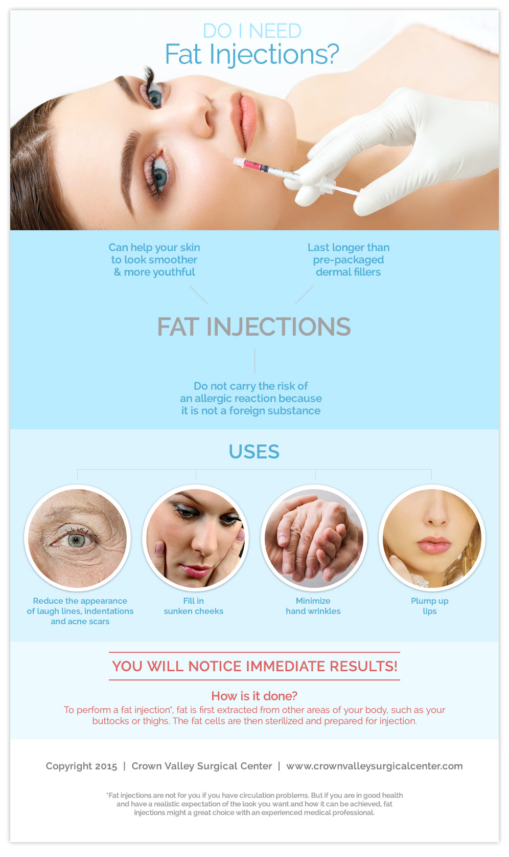 Fat Injections by Crown Valley cosmetic surgery  - Infographics